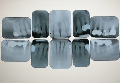 Rx madame t b3twxv - Eugenol