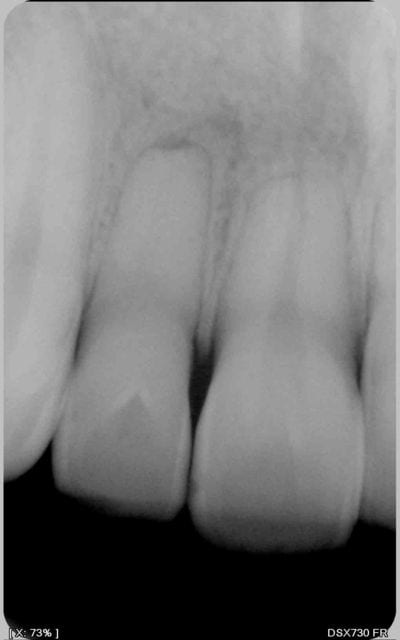 Rx1 mezri7 - Eugenol