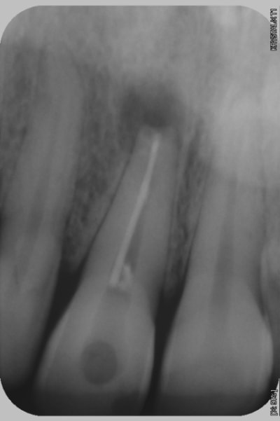 Sana mhyra4 - Eugenol