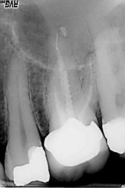 Sc33  avant ihmt3q - Eugenol