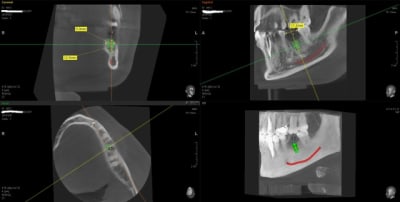 Scan3 iofgpq - Eugenol