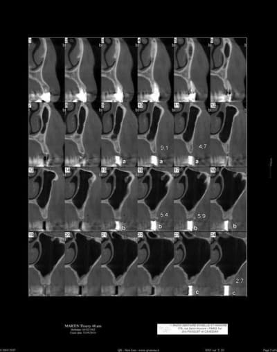 Scan gauche 1  800x600  vmuycs - Eugenol