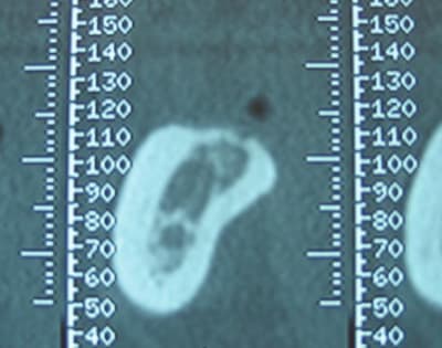 Scanner epvqpr - Eugenol