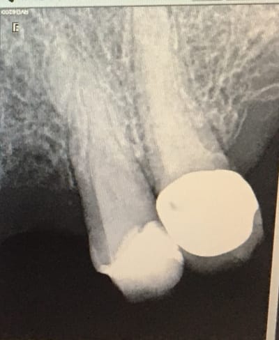 Sect2 iktoae - Eugenol