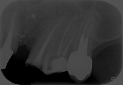 Secteur2posterieur x3hgt4 - Eugenol