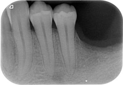 Secteur 3 post  xzjnzs - Eugenol