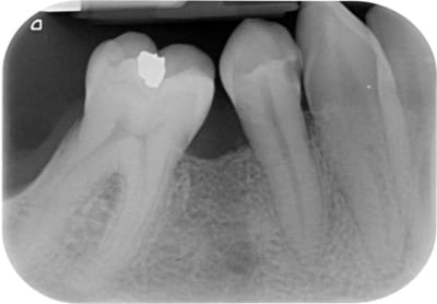 Secteur 4 post pjmqzd - Eugenol