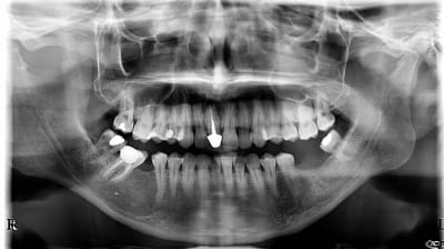 Sfnm4p2sngvkwkthmke1 - Eugenol