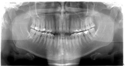 Sfqjtqxili5sem7rumlo - Eugenol