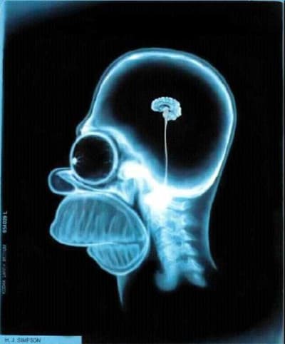 Simpson brain aeoula - Eugenol