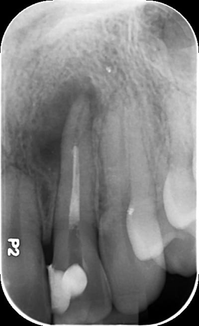 Sisc5roroy7w18mwg2tx57u3bfl5 - Eugenol