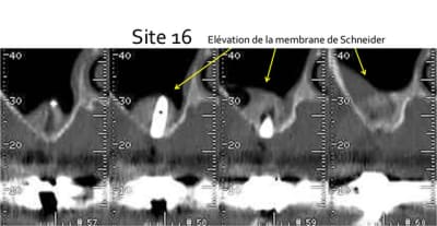 Site 16 mp6gks - Eugenol