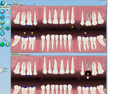 Situation 1 pwizrt - Eugenol