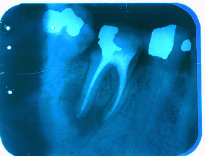 Sortons les rames  zmzice - Eugenol