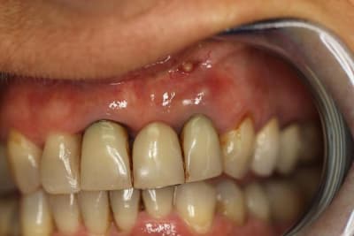 Sourire  1  ks0nsi - Eugenol