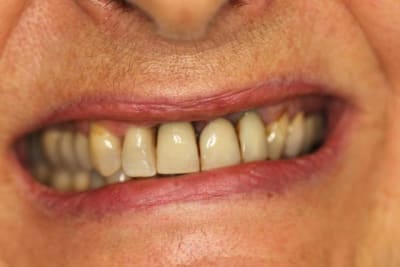 Sourire gzx7mq - Eugenol