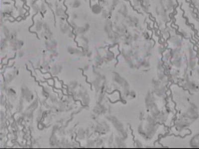 Spirochètes itf6xp - Eugenol