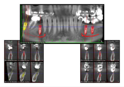 Split wqpw7w - Eugenol