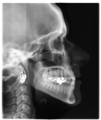 Tele kzusq7 - Eugenol