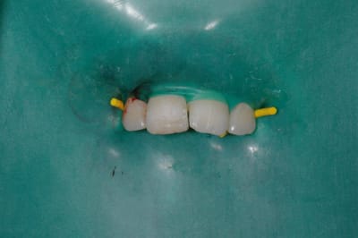 Temp vtlw4j - Eugenol