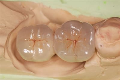 Testnm wqliid - Eugenol