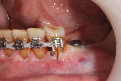 Test tmkunh - Eugenol