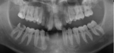 Tfczay3rgi9u7mbquyt58kov95p9 - Eugenol
