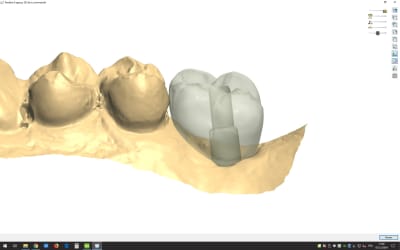 Tibase implant direct ohlvdo - Eugenol