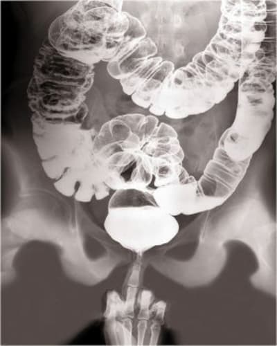 Tr d6az8m - Eugenol