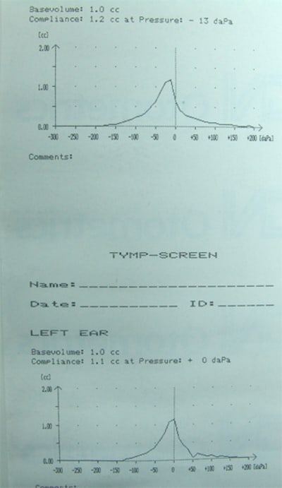 Tymp 1 fpokdu - Eugenol