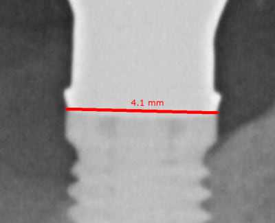 Type de plateforme r6m9ob - Eugenol