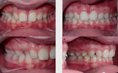 Ubdr2adggnuk5ejezh0hyt1c9lkd - Eugenol