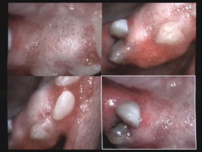 Un cas difficile paro le 1er jour 4 lgkyo8 - Eugenol