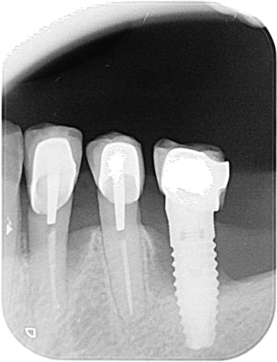 Uqskcxhsxibhtrotkubqknbk9nsm - Eugenol