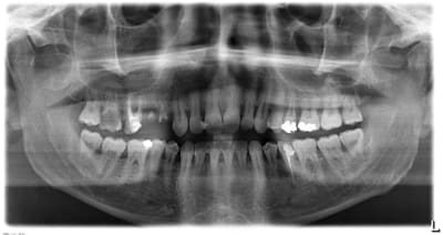 Urgence rugby mjyvdy - Eugenol