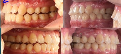 Uu7h2t35wrmev95r6r86kvkpviyz - Eugenol