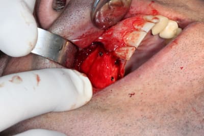 Uzan5 buklr2 - Eugenol