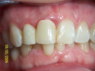 Vitt2 vk0rvf - Eugenol