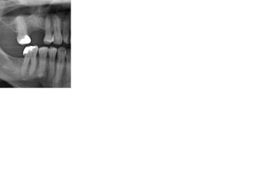 Vjcuygifv5ytmo5zhwi3 - Eugenol