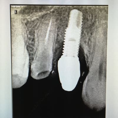 Vnh0qg2wd55asy57bjle - Eugenol