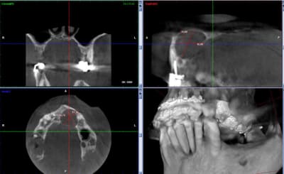 Vue 1 iyrtd6 - Eugenol