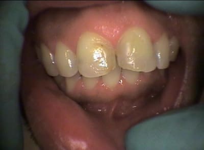 Vue vesti vffvus - Eugenol