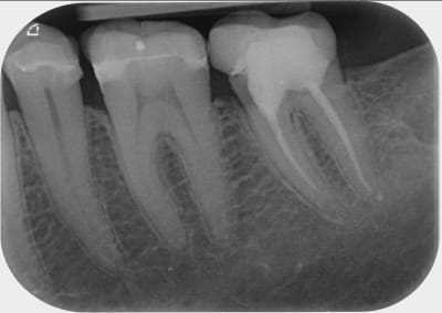 Vxbkbda8etdxfvbvwljh - Eugenol