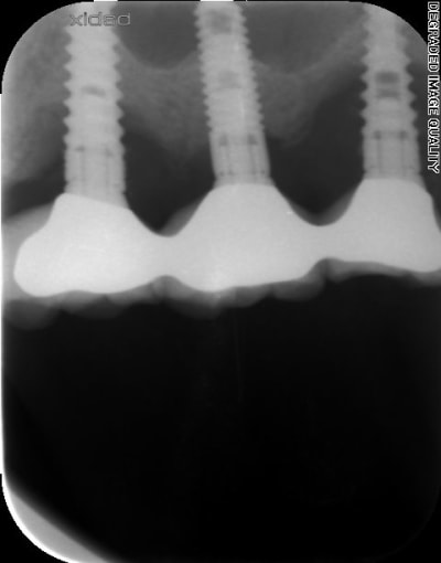 W59oisrsjkxesf4f3glx - Eugenol