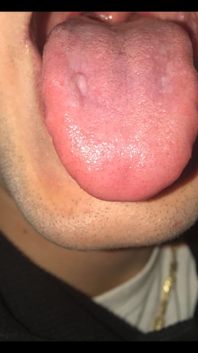 Wbfg3039fsmxutd5vv2x - Eugenol