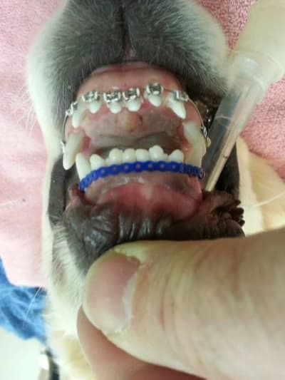 Wesly brackets rs5sil - Eugenol