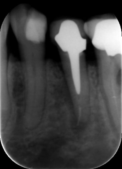 Wolff ipg0vw - Eugenol