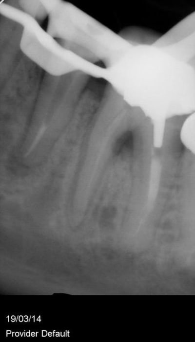 Wolff zcxuws - Eugenol