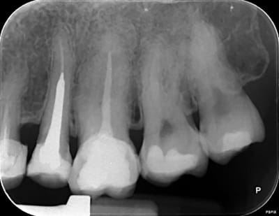 Wowegfamzbyq0wmihkx0 - Eugenol