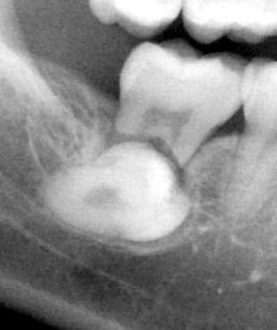 Wu   copie nwukel - Eugenol